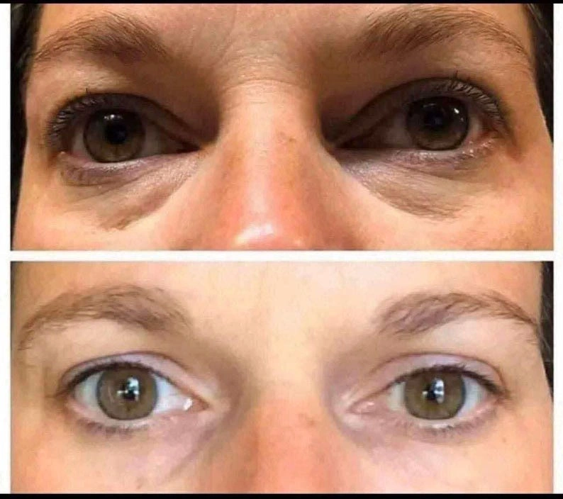 LumiSpa IdealEyes Activating Eye Cream: Dark Circles, Bags, Fine Lines - Image 7