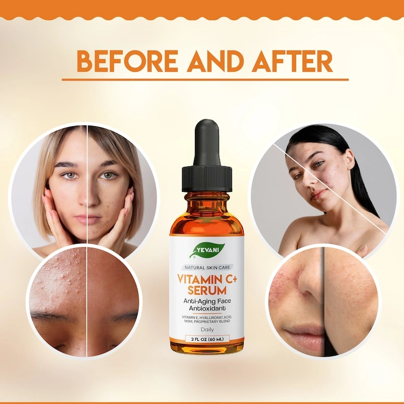 100% Pure Vitamin C Serum, Anti-Aging Face Serum with Hyaluronic Acid, Eye Area, Dark Spots, Anti-Aging, Fine Lines, Wrinkles, 2 FL OZ - Image 5